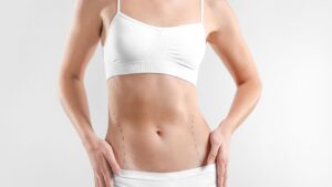 Best Type of Abdominoplasty Surgery