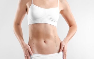 Best Type of Abdominoplasty Surgery