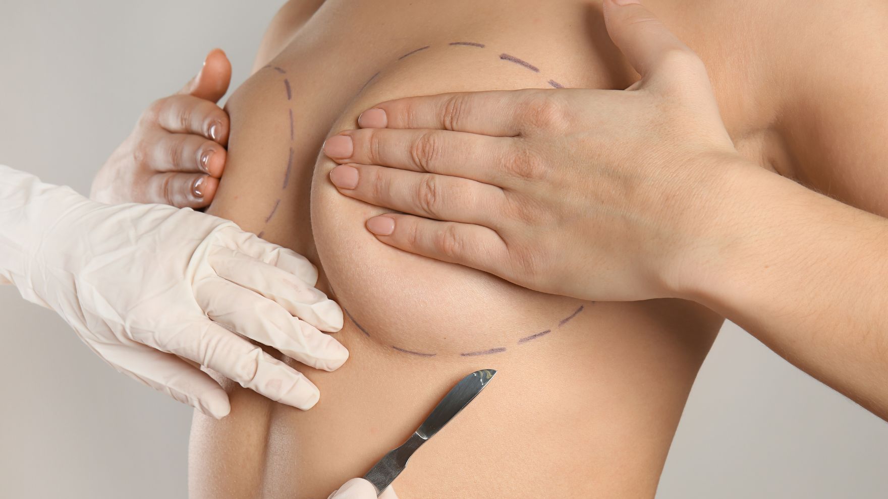 difference between a breast lift and a breast reduction