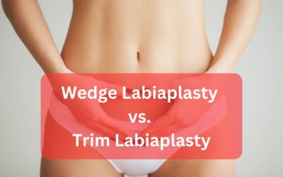 Wedge Labiaplasty vs. Trim Labiaplasty: A Complete Guide