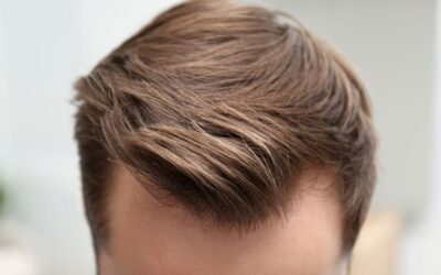 The Best Type of Hair Transplant 2024