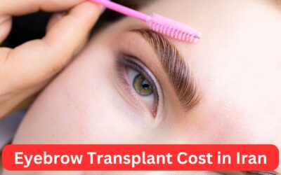 Eyebrow Transplant Cost in Iran