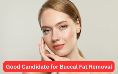 Good Candidate for Buccal Fat Removal Surgery