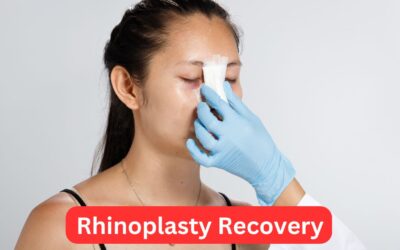 Rhinoplasty Recovery: What You Need to Know