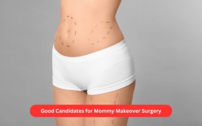 Am I a Good Candidate for Mommy Makeover Surgery?