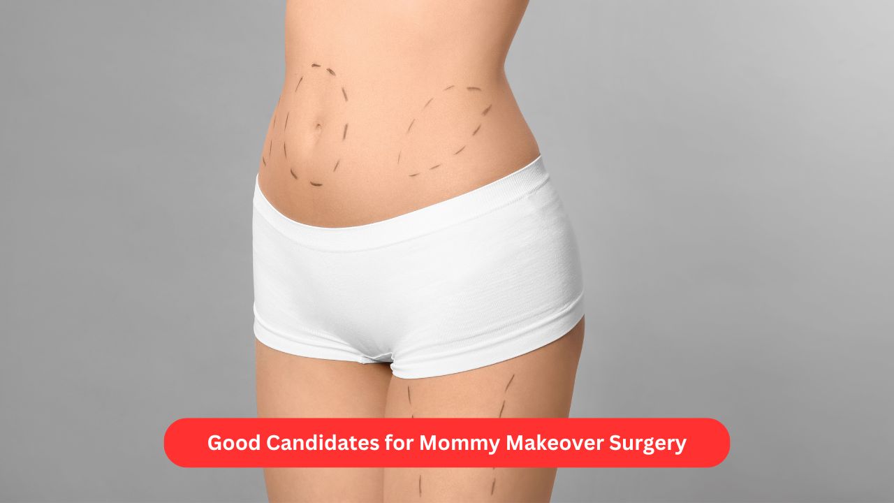 Good Candidate for Mommy Makeover Surgery