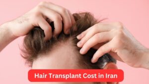 Hair Transplant Cost in Iran