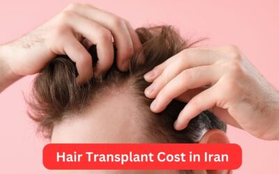 Hair Transplant Cost in Iran