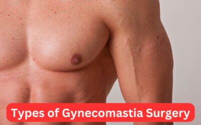 Types of Gynecomastia Surgery