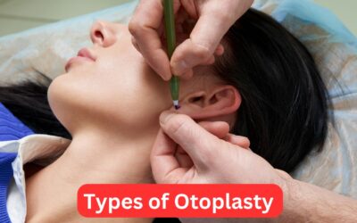 Types of Otoplasty