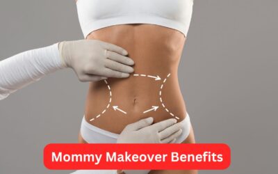 What Are The Mommy Makeover Benefits?