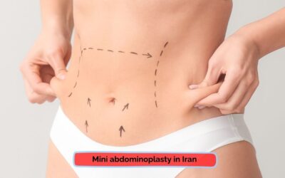 Mini Abdominoplasty in Iran | Mini Tummy Tuck in Iran