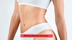 mommy makeover recovery