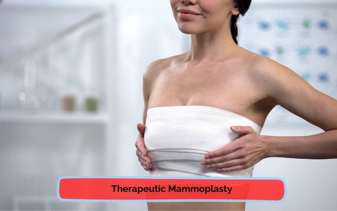 What is Therapeutic Mammoplasty? | Therapeutic Mammoplasty in Iran