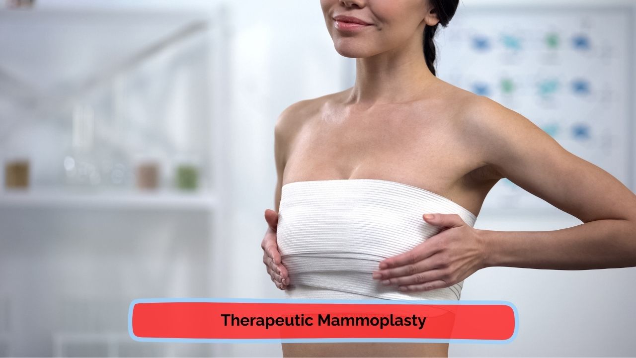 Therapeutic Mammoplasty